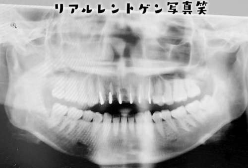 【比較画像】益若つばさの顔が激変したのは整形が理由？劣化が凄くて別人級！