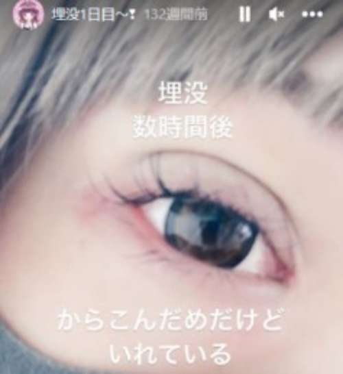 頂き女子りりちゃんの素顔やすっぴん画像はある?法廷画や整形前が別人級!