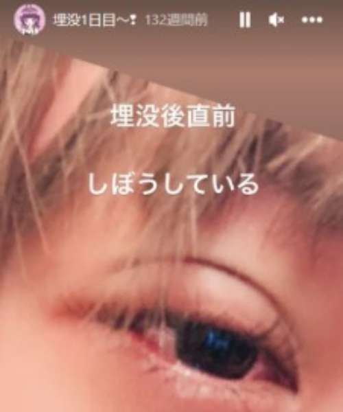頂き女子りりちゃんの素顔やすっぴん画像はある?法廷画や整形前が別人級!