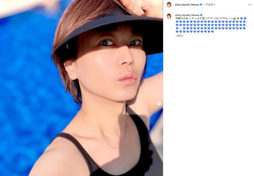 【画像】氷川きよしの胸の膨らみの理由はなぜ？豊胸や性転換手術の可能性は？